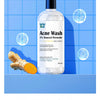 WildOak 5% Benzoyl Peroxide Acne Wash vs. THE SOLVED SKIN Anti-Acne Facewash: Which One Should You Choose?