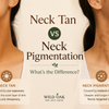 Neck Tan vs Neck Pigmentation: How to Tell the Difference and Treat Each