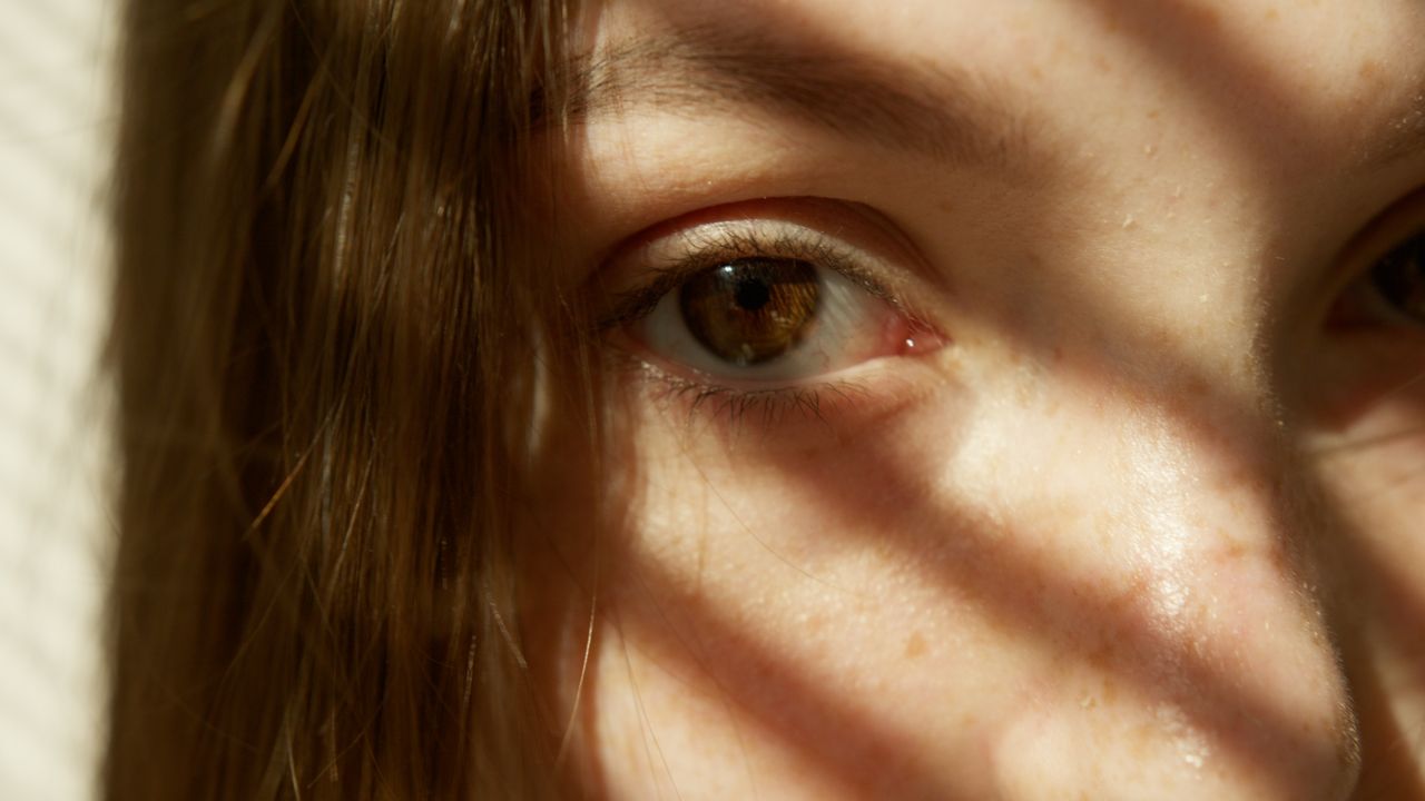 Top 10 Products for Dark Spots and Pigmentation