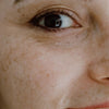 Top 10 Products for Dark Spots and Pigmentation | WildOak
