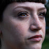 Retinol for Dark Spots: A Powerful Solution for Hyperpigmentation