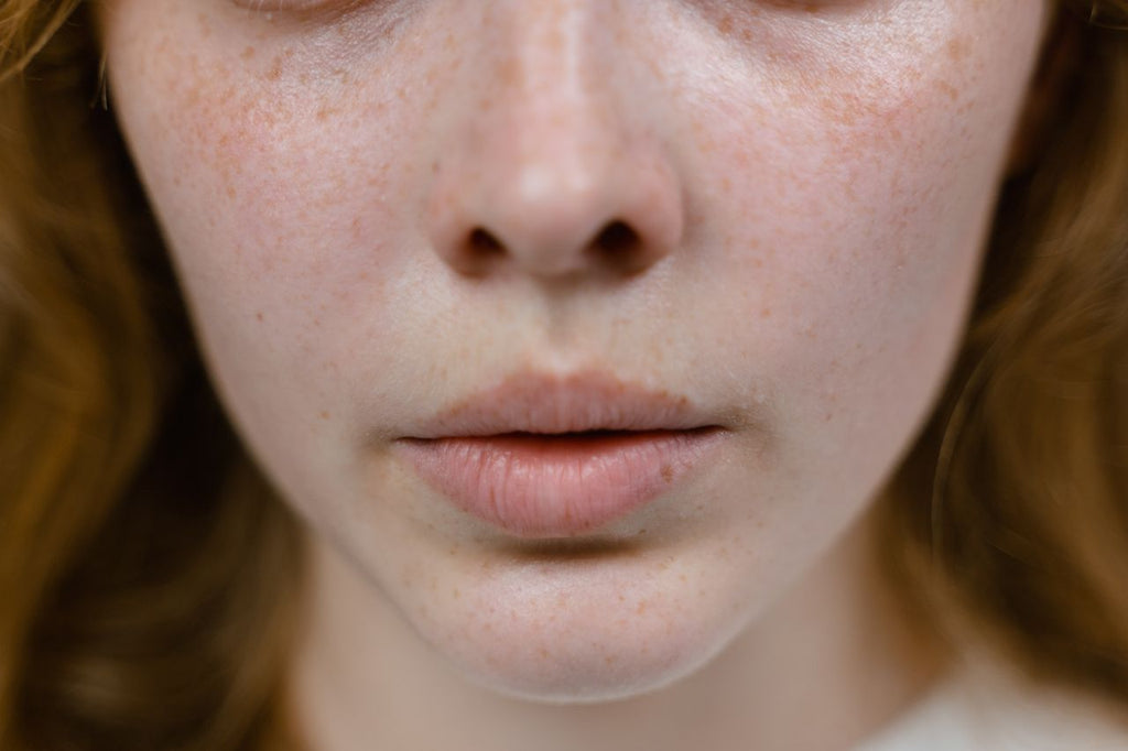 Top 5 Benzoyl Peroxide Body Washes for Back Acne in India